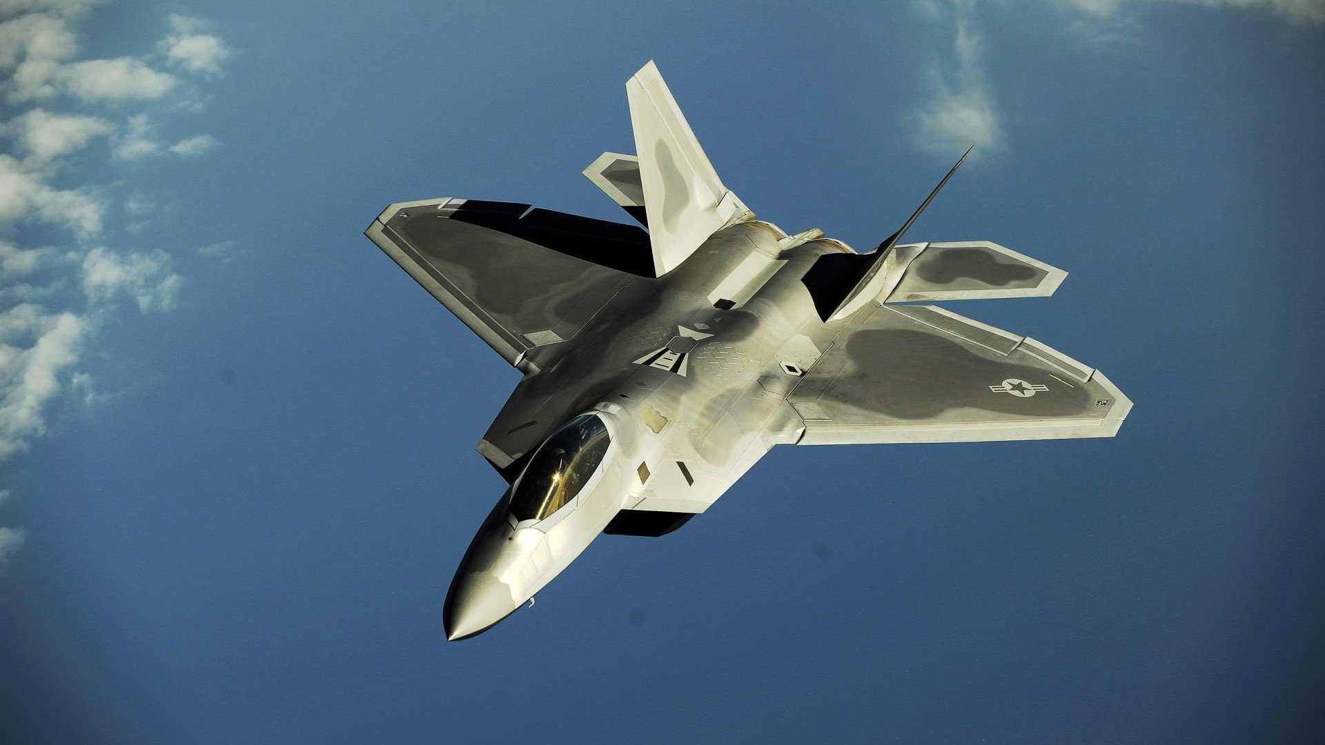 NBA球员伤病风险预测及预防机制，nba球员伤病工资怎么算